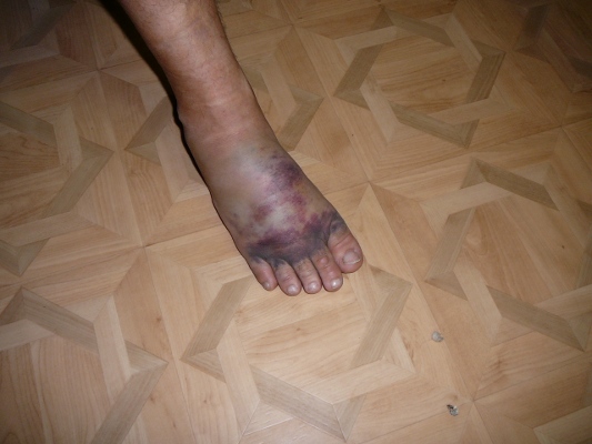 JalkaPaalta.JPG